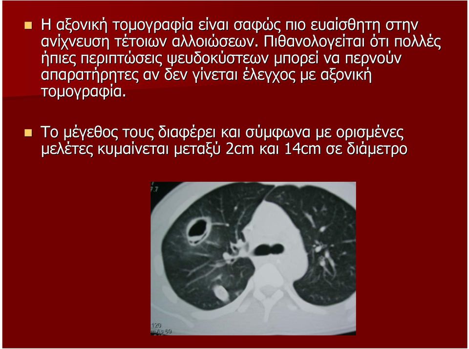Πιθανολογείται ότι πολλές ήπιες περιπτώσεις ψευδοκύστεων µπορεί να περνούν