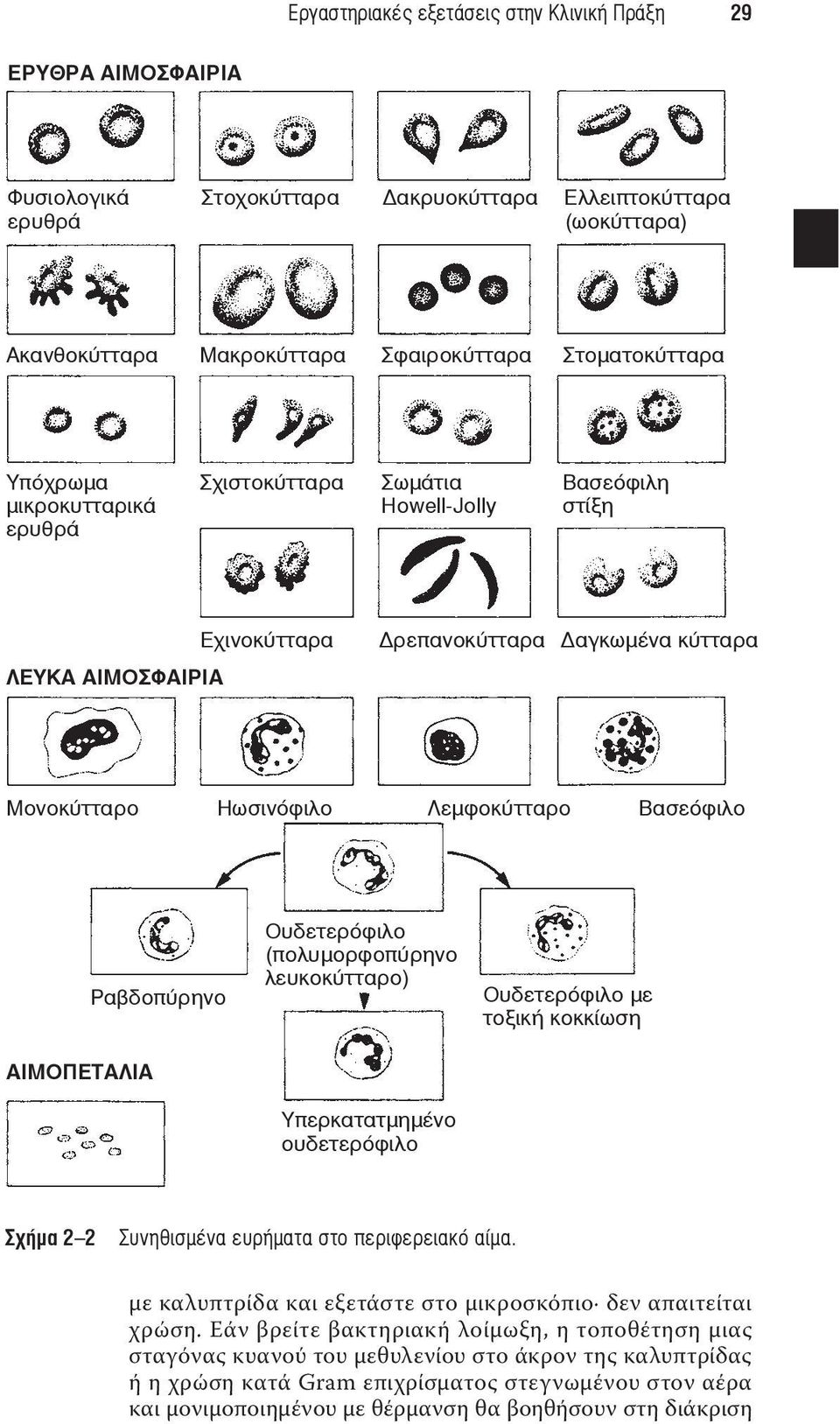 ΑΙΜΟΠΕΤΑΛΙΑ Ραβδοπύρηνο Ουδετερόφιλο (πολυμορφοπύρηνο λευκοκύτταρο) Υπερκατατμημένο ουδετερόφιλο Ουδετερόφιλο με τοξική κοκκίωση Σχήμα 2 2 Συνηθισμένα ευρήματα στο περιφερειακό αίμα.