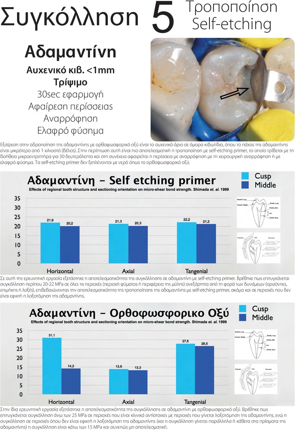 αδαµαντίνης είναι µικρότερο από 1 χιλιοστό (βέλος).