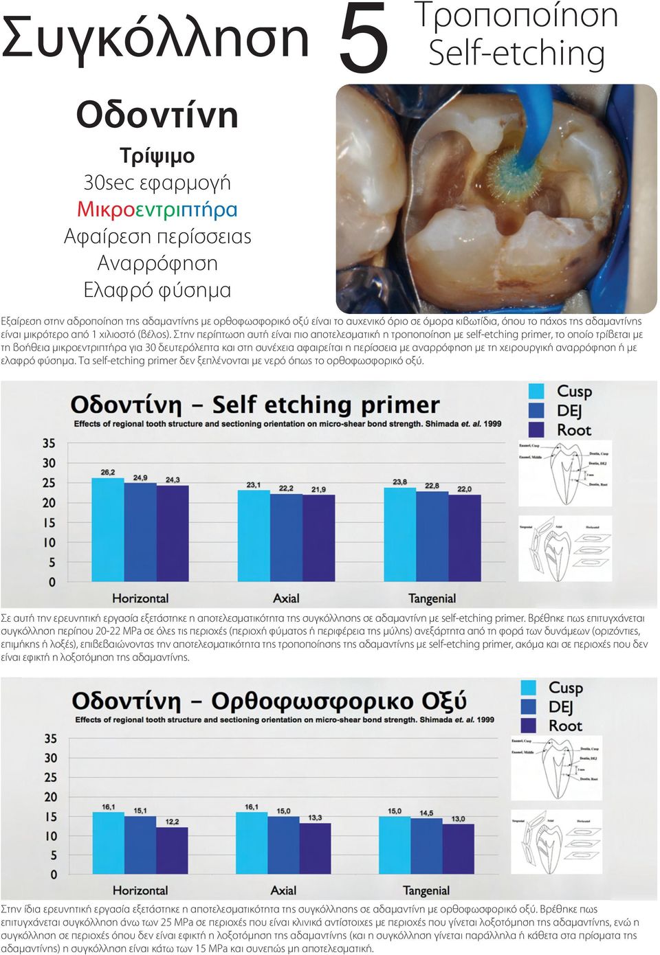 Στην περίπτωση αυτή είναι πιο αποτελεσµατική η τροποποίηση µε self-etching primer, το οποίο τρίβεται µε τη βοήθεια µικροεντριπτήρα για 30 δευτερόλεπτα και στη συνέχεια αφαιρείται η περίσσεια µε
