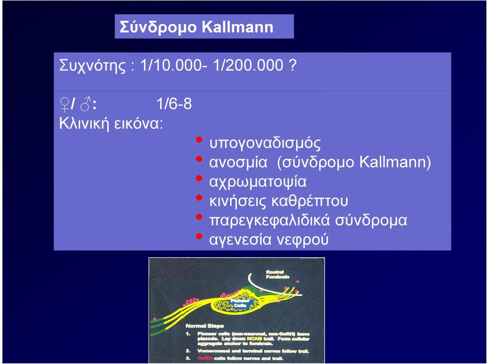 / : 1/6-8 Κλινική εικόνα: υπογοναδισμός ανοσμία