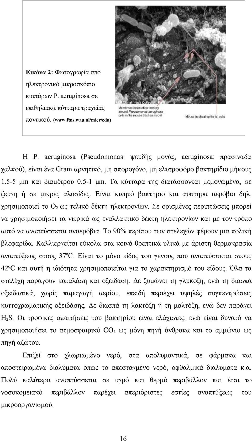 Τα κύτταρά της διατάσσονται μεμονωμένα, σε ζεύγη ή σε μικρές αλυσίδες. Είναι κινητό βακτήριο και αυστηρά αερόβιο δηλ. χρησιμοποιεί το O2 ως τελικό δέκτη ηλεκτρονίων.