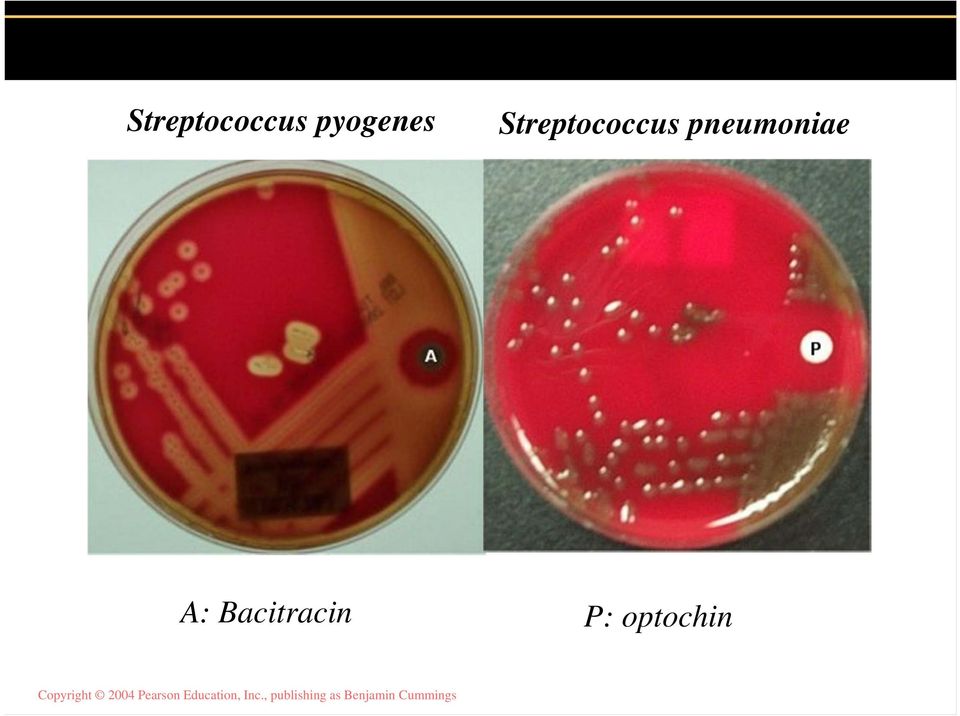 pneumoniae A: