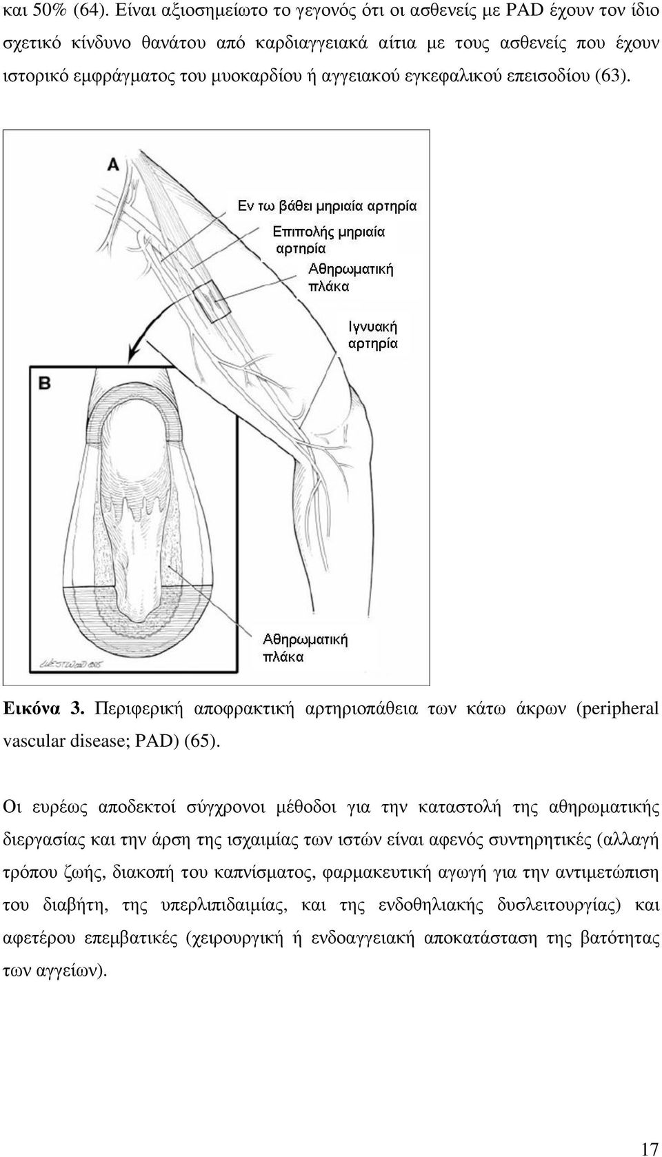 αγγειακού εγκεφαλικού επεισοδίου (63). Εικόνα 3. Περιφερική αποφρακτική αρτηριοπάθεια των κάτω άκρων (peripheral vascular disease; PAD) (65).