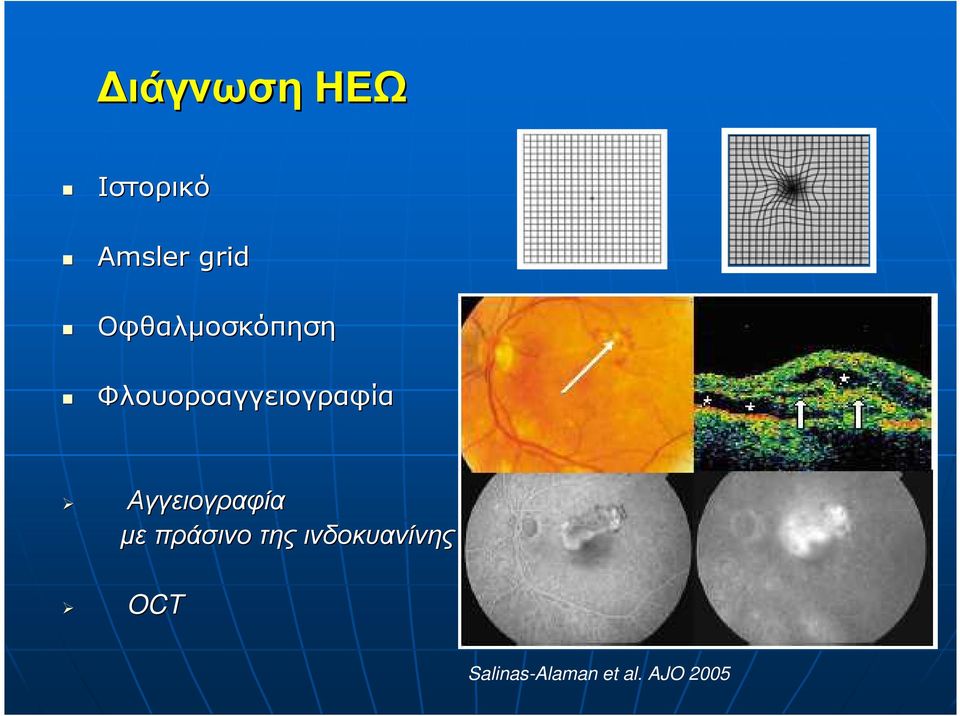 Αγγειογραφία µε πράσινο της