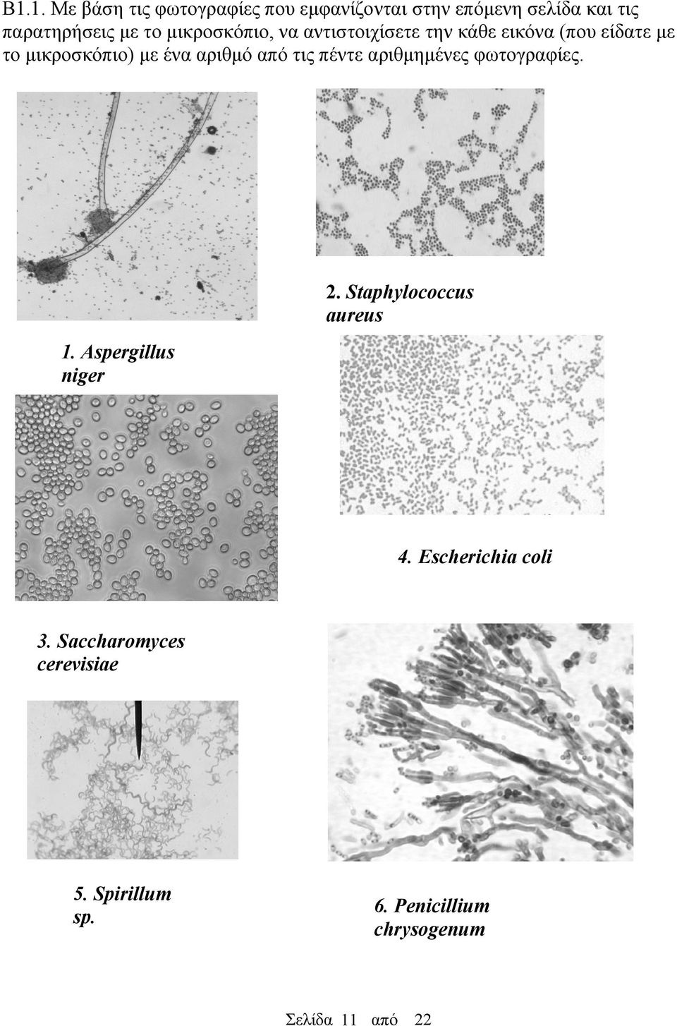 από τις πέντε αριθμημένες φωτογραφίες. 2. Staphylococcus aureus 1. Aspergillus niger 4.