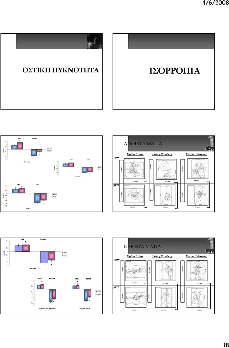 6 (mm),5,5 BMD T-score ΚΛΕΙΣΤΑ ΜΑΤΙΑ (g/cm2) -,5 - -,5-2 2ου-4ου Ο.Σ. 2 (mm) Όρθια Στάση 26.6 (mm) Στάση Romberg 36.