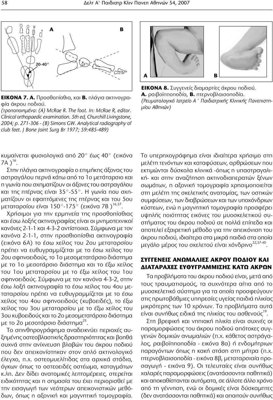 Συγγενείς διαμαρτίες άκρου ποδιού. A. ραιβοϊπποποδία, B. πτερνοβλαισοποδία. (Ρευματολογικό Ιατρείο Α Παιδιατρικής Κλινικής Πανεπιστημίου Αθηνών) κυμαίνεται φυσιολογικά από 20 έως 40 (εικόνα 7Α ) 16.