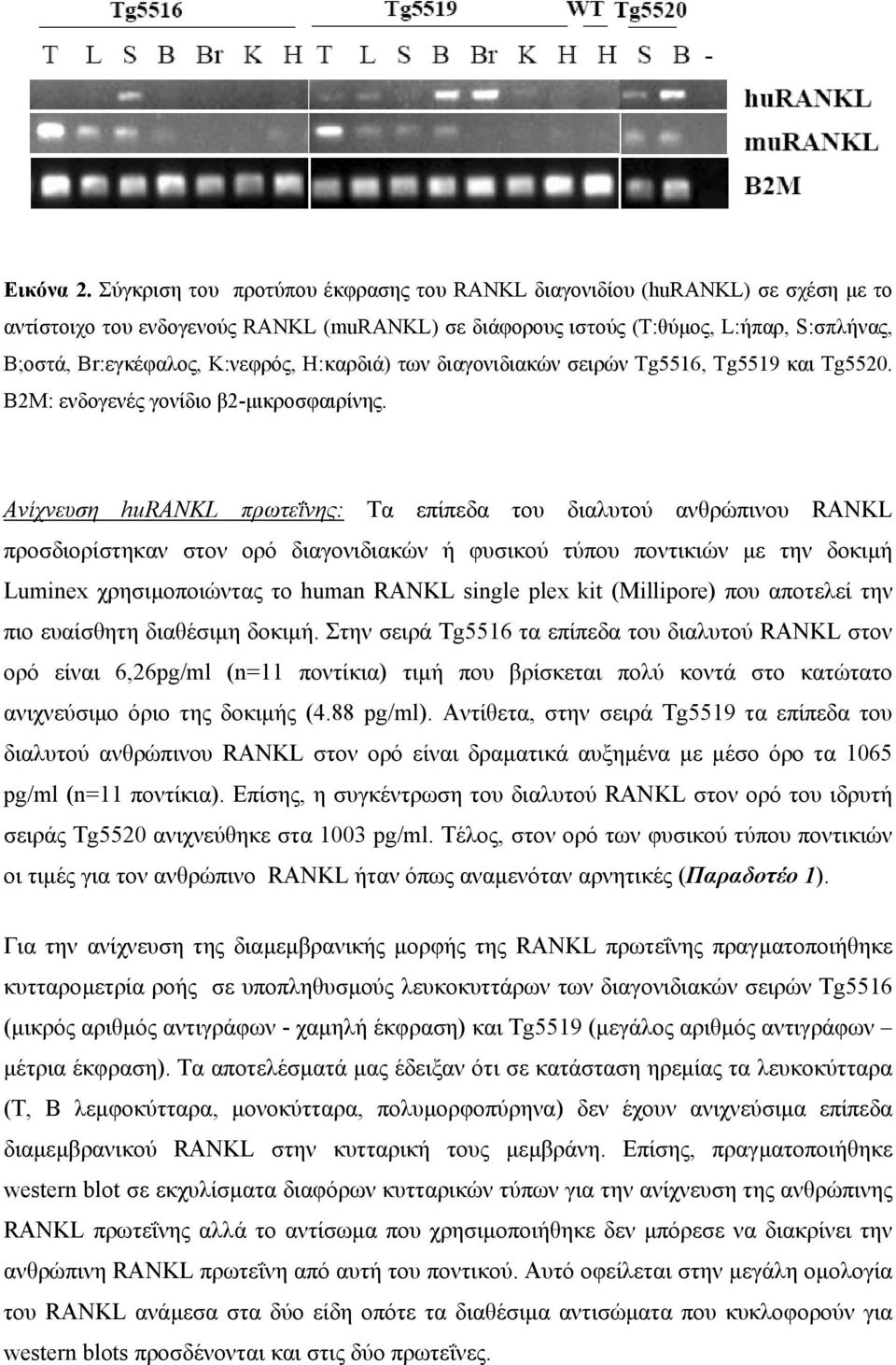 K:νεφρός, H:καρδιά) των διαγονιδιακών σειρών Tg5516, Tg5519 και Tg5520. Β2Μ: ενδογενές γονίδιο β2-µικροσφαιρίνης.