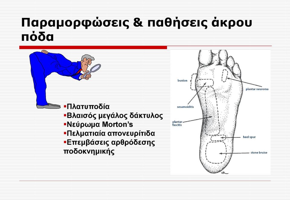 Νεύξσκα Morton s Πεικαηηαία