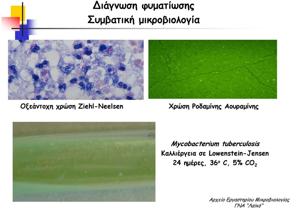 Mycobacterium tuberculosis Καλλιέργεια σε