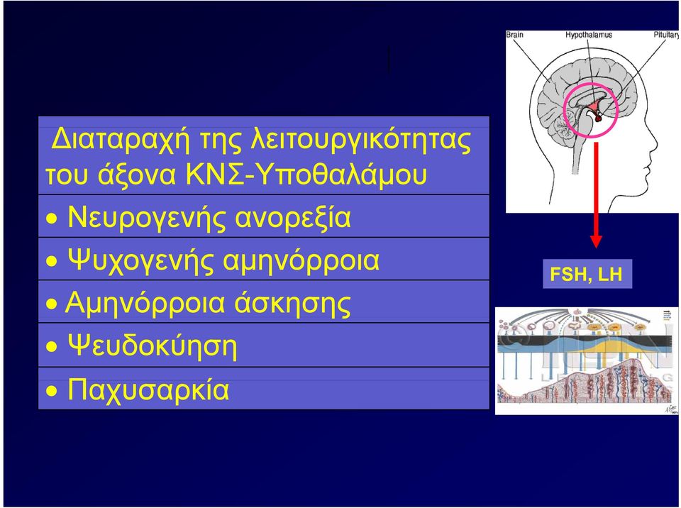 ανορεξία Ψυχογενής αμηνόρροια