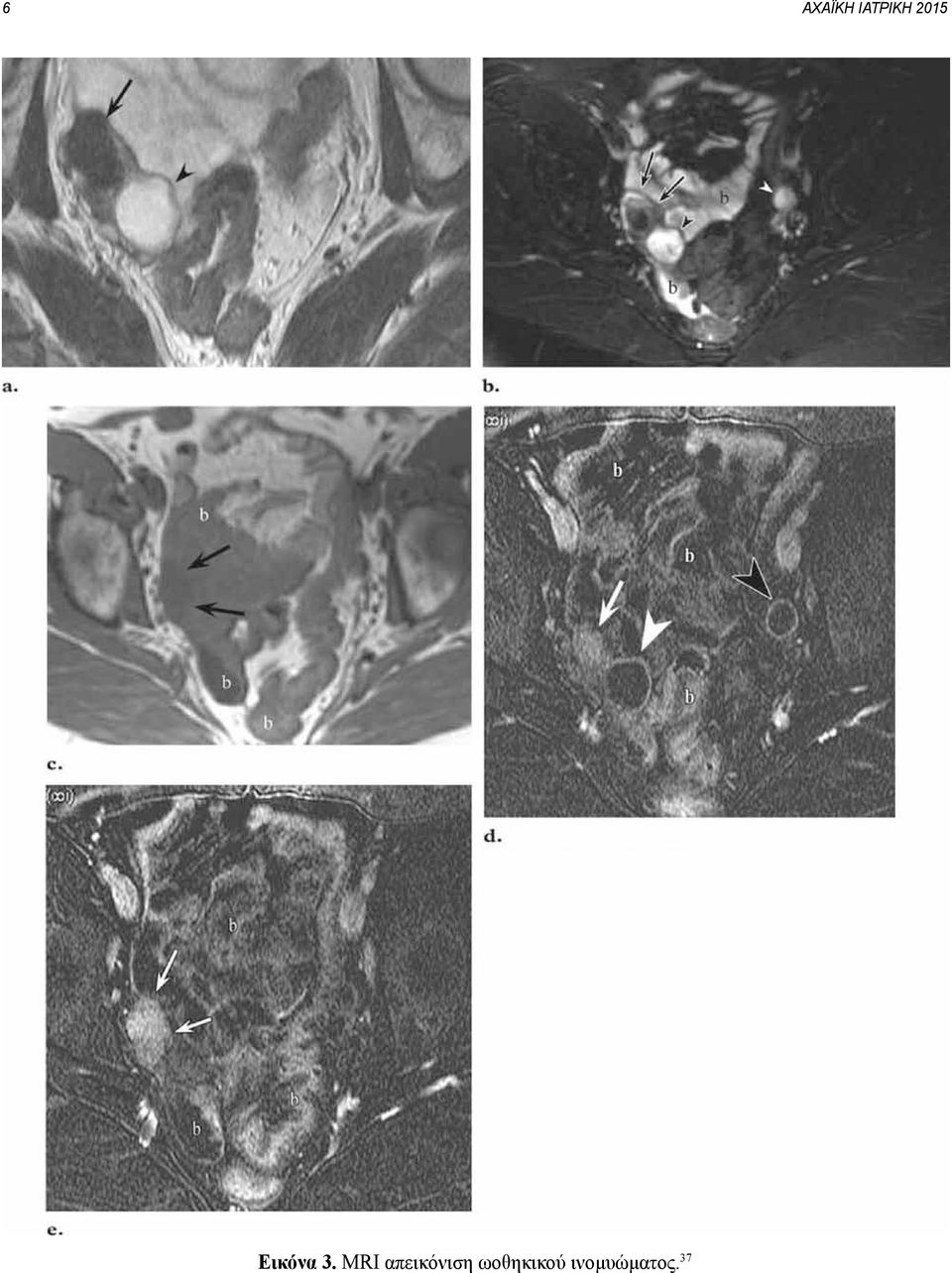 MRI απεικόνιση