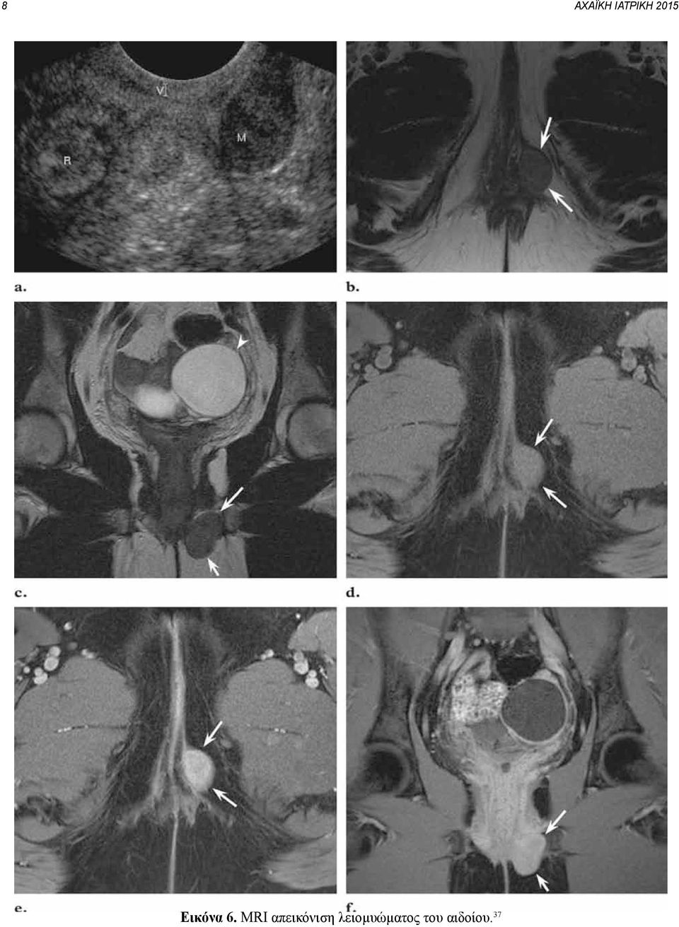 MRI απεικόνιση