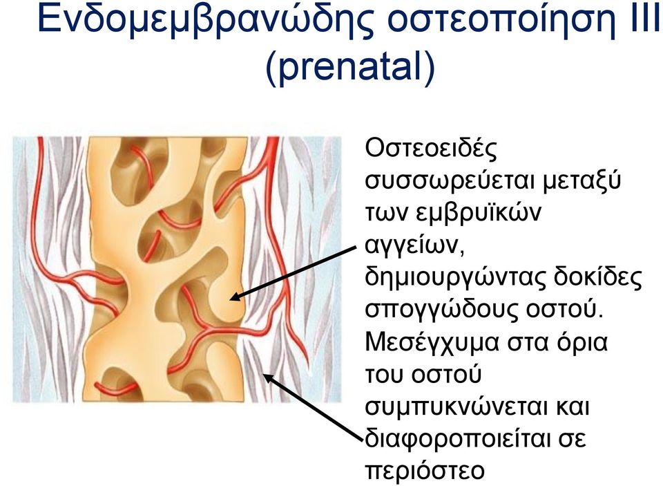 αγγείων, δημιουργώντας δοκίδες σπογγώδους οστού.