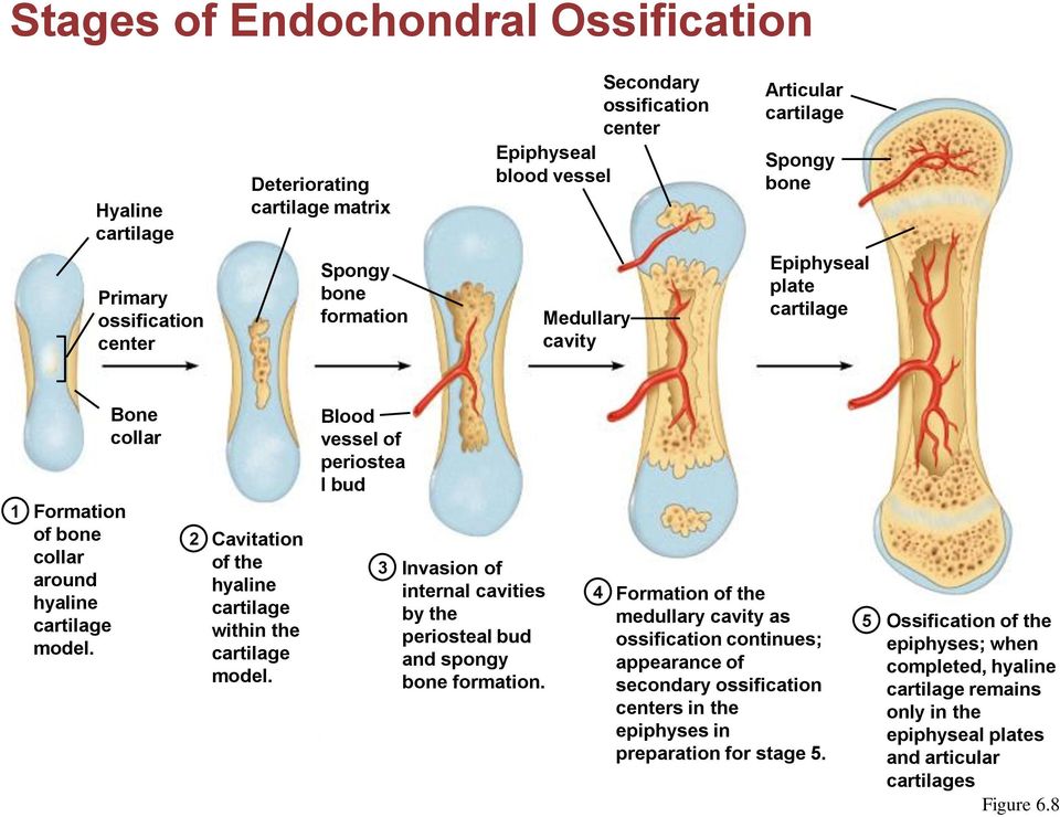 Bone collar 2 Cavitation of the hyaline cartilage within the cartilage model. Blood vessel of periostea l bud 3 Invasion of internal cavities by the periosteal bud and spongy bone formation.