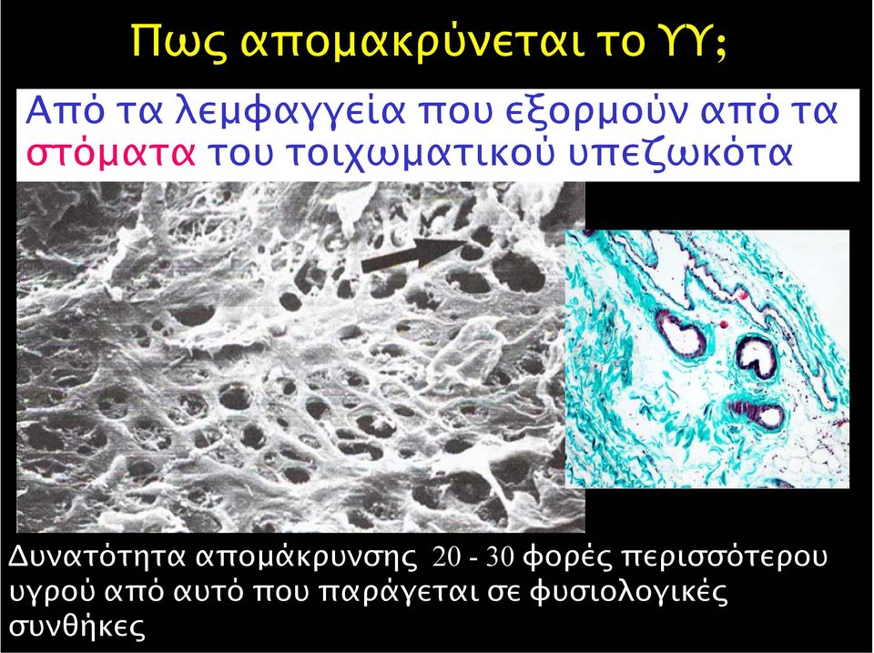 υπεζωκότα υνατότητα αποµάκρυνσης 20-30 φορές