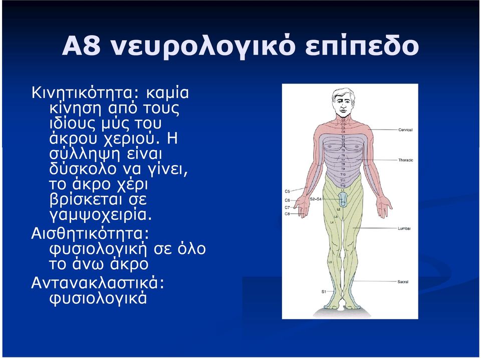 Η σύλληψη είναι δύσκολο να γίνει, το άκρο χέρι βρίσκεται