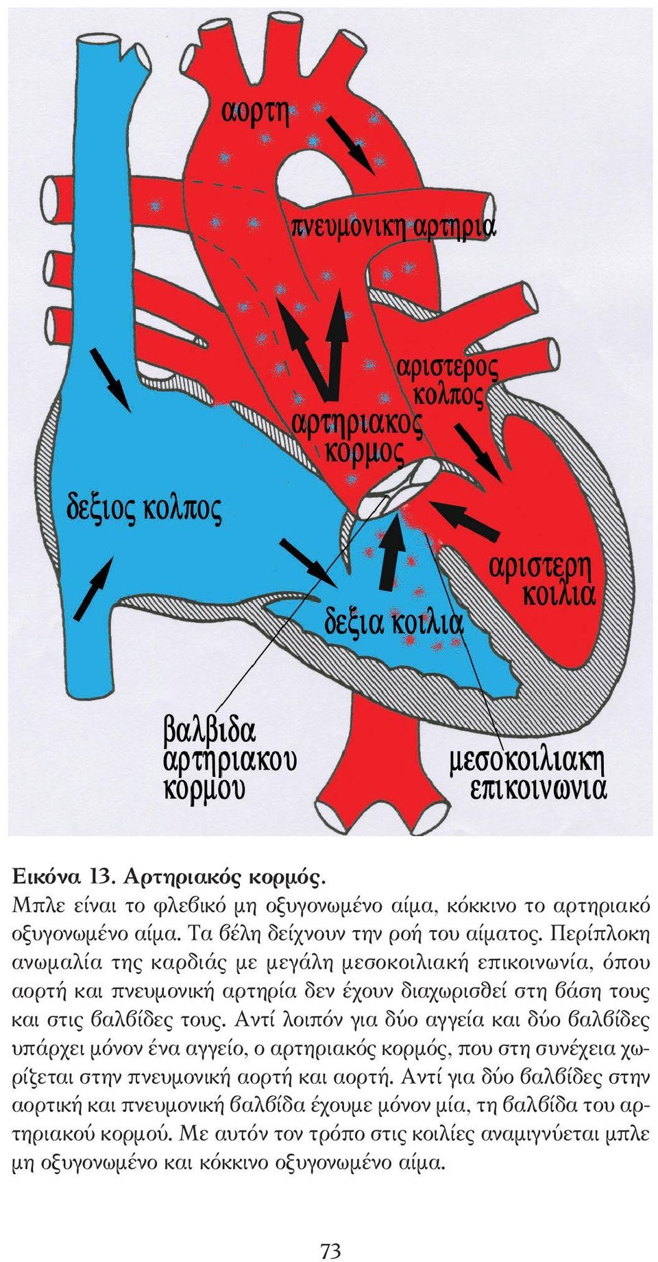 Αντί λοιπόν για δύο αγγεία και δύο βαλβίδες υπάρχει µόνον ένα αγγείο, ο αρτηριακός κορµός, που στη συνέχεια χωρίζεται στην πνευµονική αορτή και αορτή.