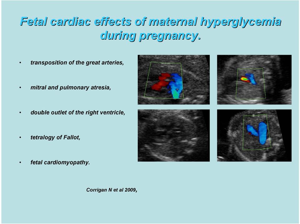 transposition of the great arteries, mitral and pulmonary