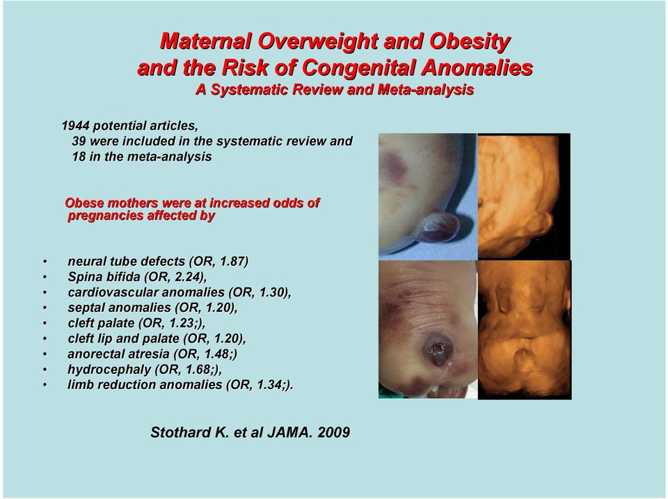 tube defects (OR, 1.87) Spina bifida (OR, 2.24), cardiovascular anomalies (OR, 1.30), septal anomalies (OR, 1.20), cleft palate (OR, 1.