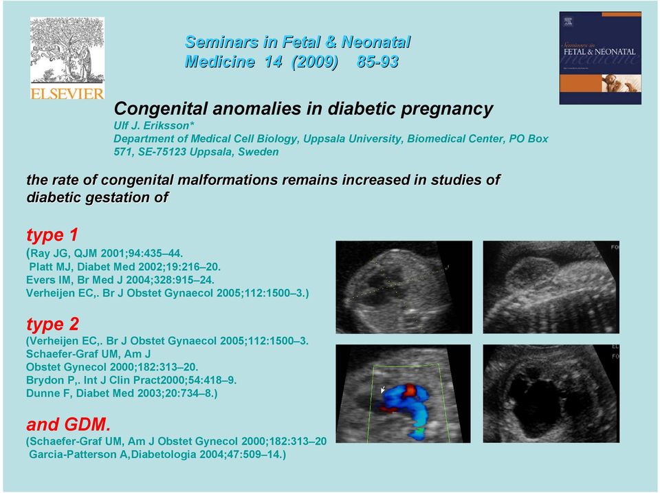 diabetic gestation of type 1 (Ray JG, QJM 2001;94:435 44. Platt MJ, Diabet Med 2002;19:216 20. Evers IM, Br Med J 2004;328:915 24. Verheijen EC,. Br J Obstet Gynaecol 2005;112:1500 3.