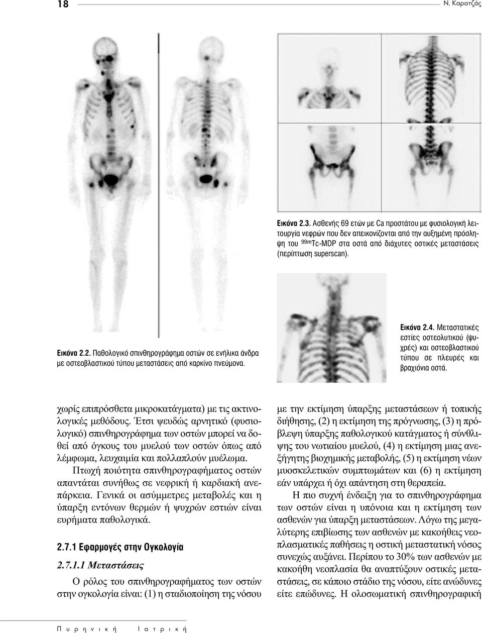 superscan). ÈÎfiÓ 2.2. ıôïôáèîfi ÛappleÈÓıËÚÔÁÚ ÊËÌ ÔÛÙÒÓ ÛÂ ÂÓ ÏÈÎ Ó Ú ÌÂ ÔÛÙÂÔ Ï ÛÙÈÎÔ Ù appleô ÌÂÙ ÛÙ ÛÂÈ applefi Î ÚÎ ÓÔ appleóâ ÌÔÓ. ÈÎfiÓ 2.4.