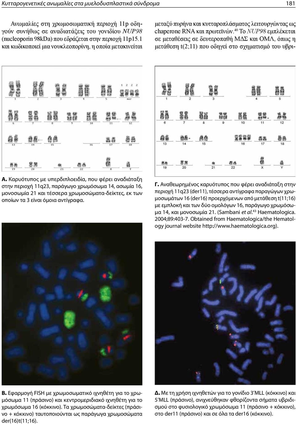40 Το NUP98 εμπλέκεται σε μεταθέσεις σε δευτεροπαθή ΜΔΣ και ΟΜΛ, όπως η μετάθεση t(2;11) που οδηγεί στο σχηματισμό του υβρι- Α.