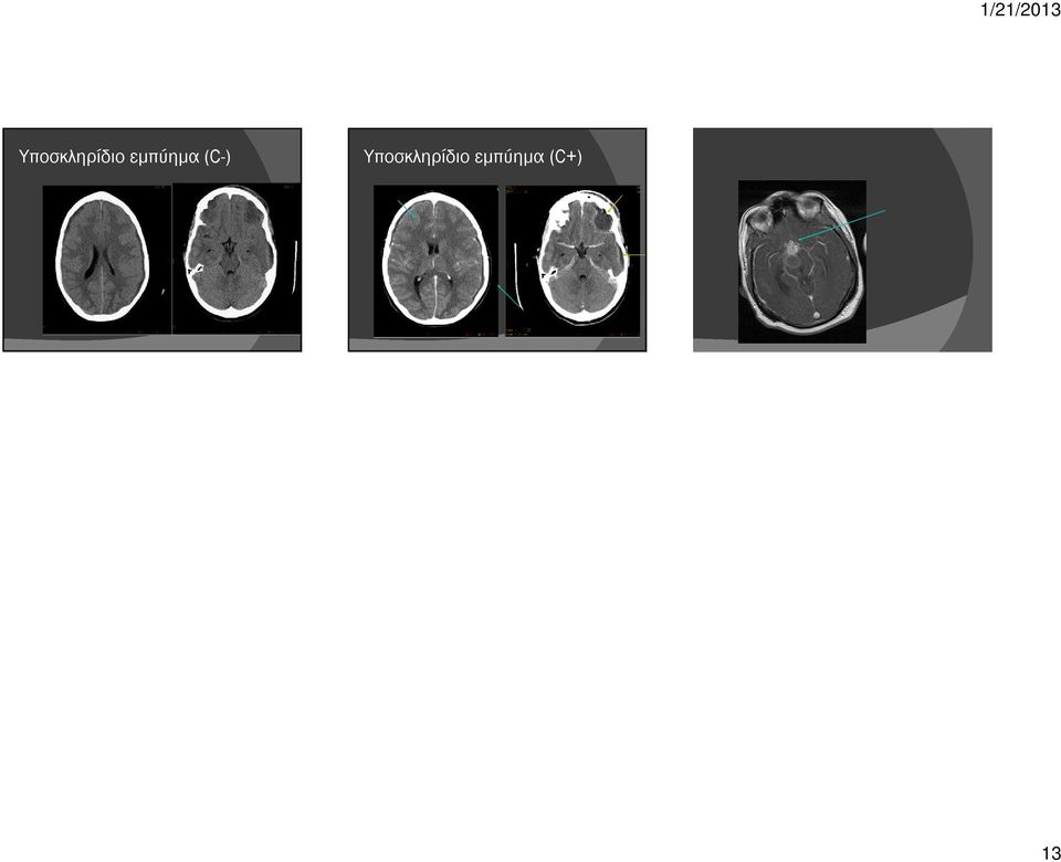 - λοιμώδης MRI (.,, ) (.,, - ) (.