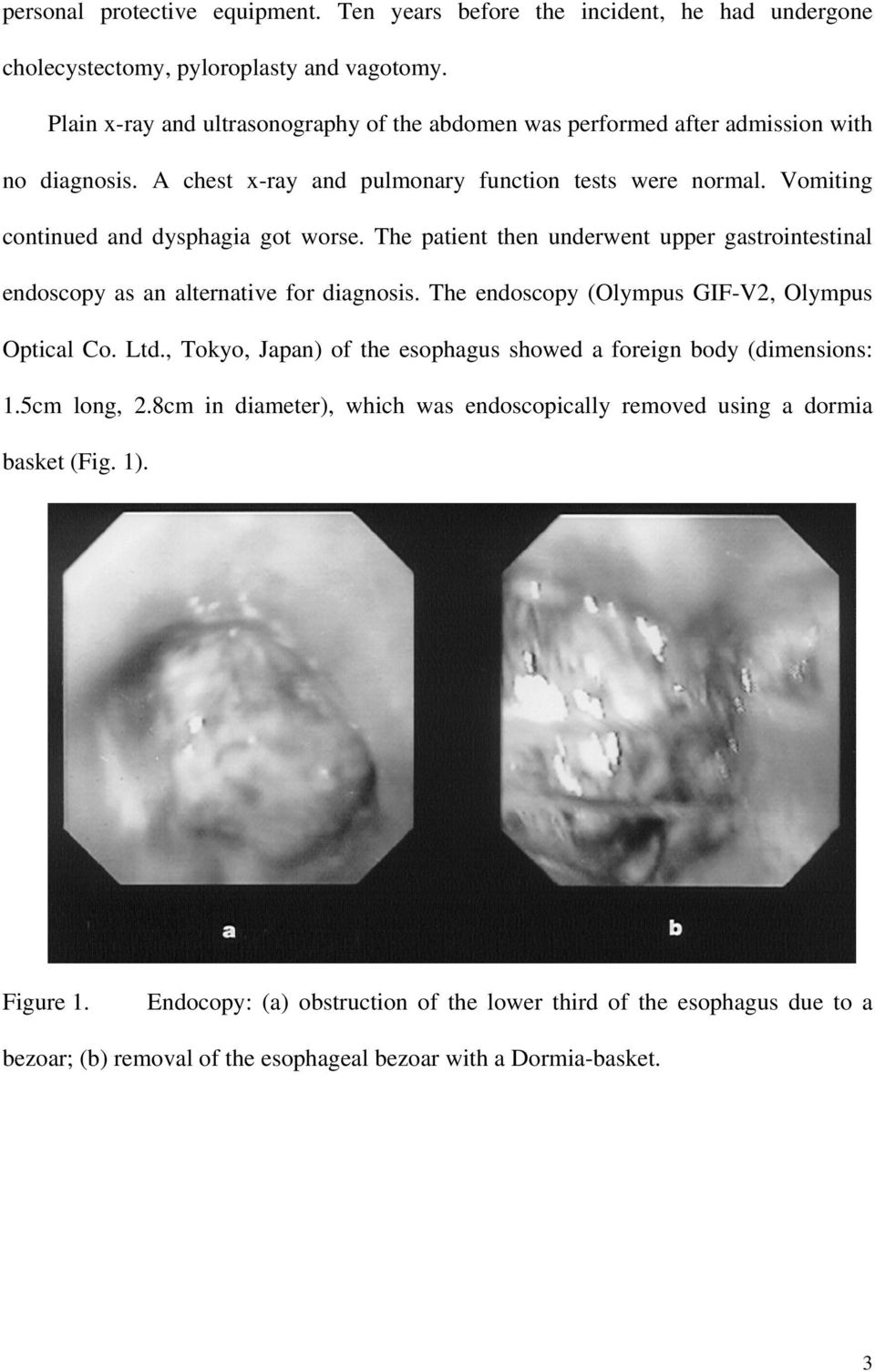 The patient then underwent upper gastrointestinal endoscopy as an alternative for diagnosis. The endoscopy (Olympus GIF-V2, Olympus Optical Co. Ltd.