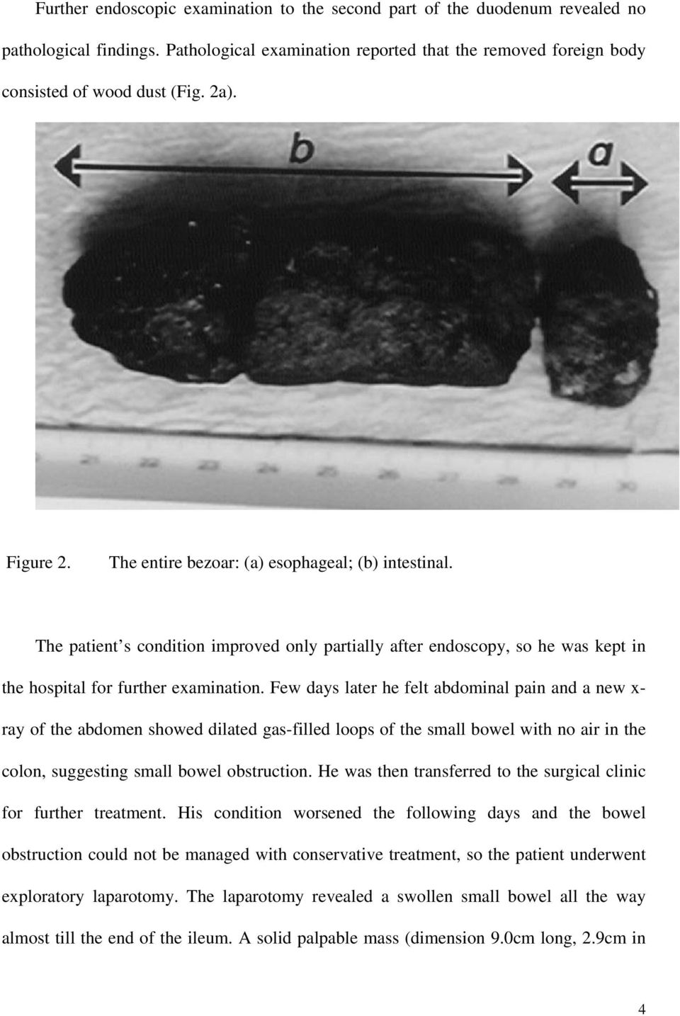 Few days later he felt abdominal pain and a new x- ray of the abdomen showed dilated gas-filled loops of the small bowel with no air in the colon, suggesting small bowel obstruction.