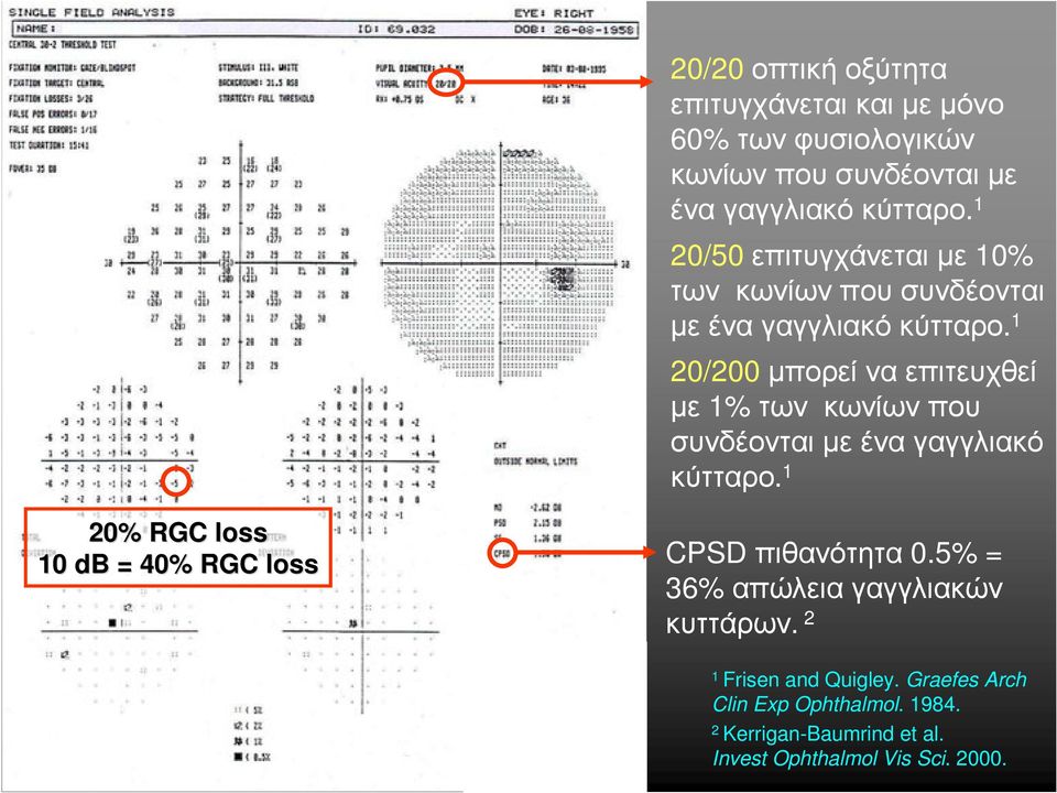 1 20/200 µπορεί να επιτευχθεί µε 1% των κωνίωνπου συνδέονται µε ένα γαγγλιακό κύτταρο.