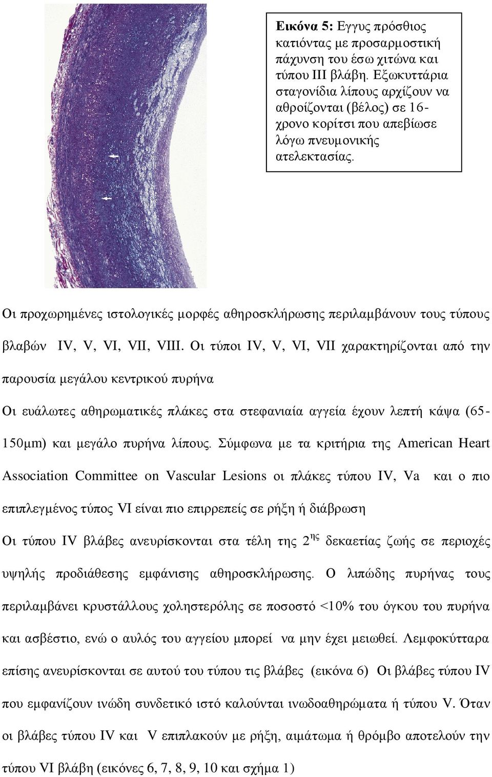 Οη πξνρσξεκέλεο ηζηνινγηθέο κνξθέο αζεξνζθιήξσζεο πεξηιακβάλνπλ ηνπο ηύπνπο βιαβώλ IV, V, VI, VII, VIII.