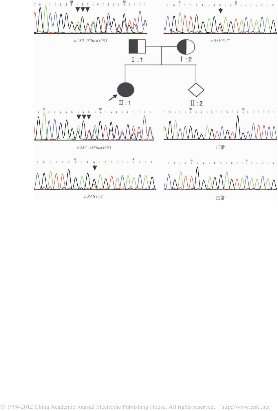 3 GR NSKOV K E K J SAND A et al. Birth prevalence andmutation spectrumin Danish patients with autosomal recessive albinism J.