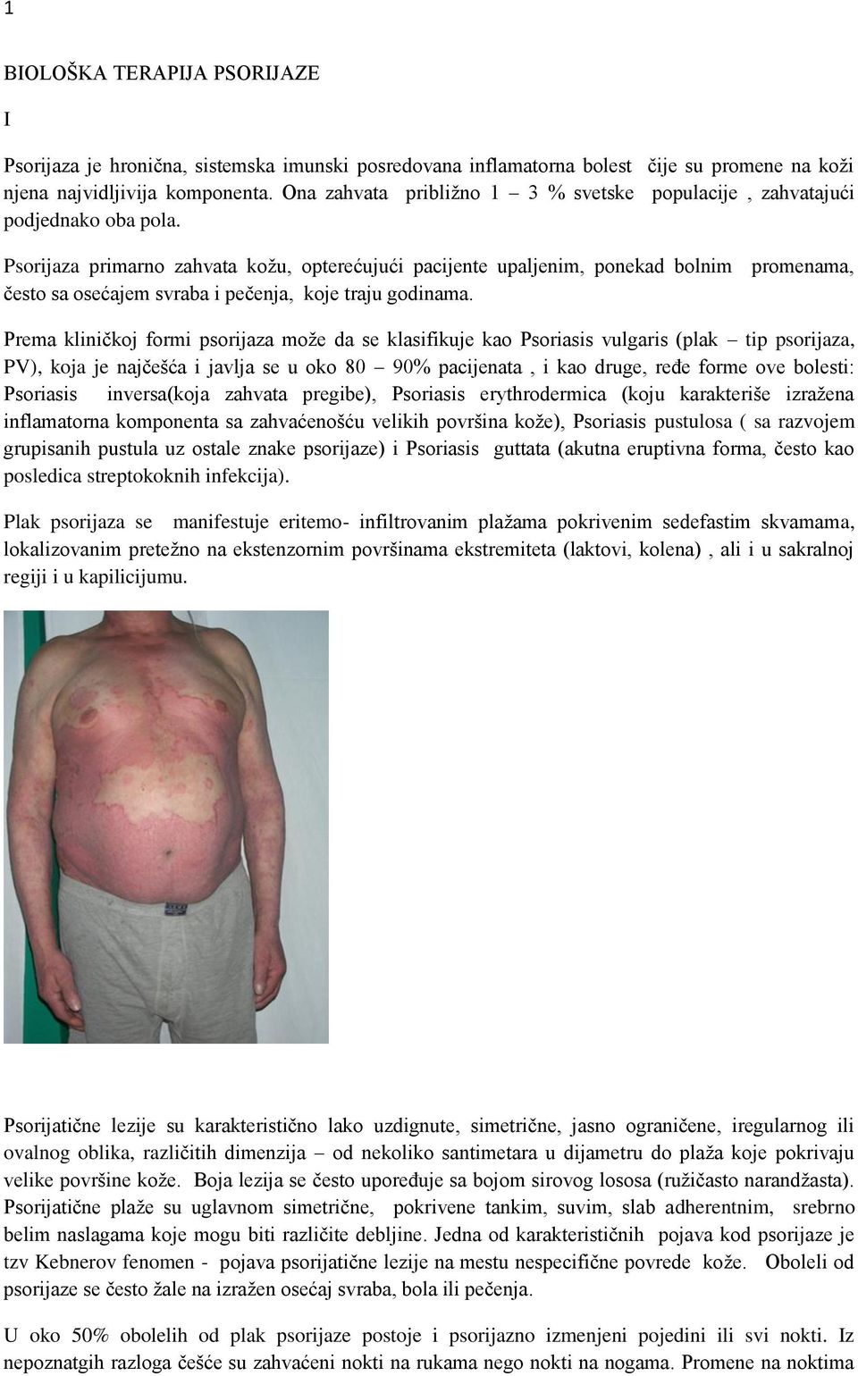 Psorijaza primarno zahvata kožu, opterećujući pacijente upaljenim, ponekad bolnim promenama, često sa osećajem svraba i pečenja, koje traju godinama.