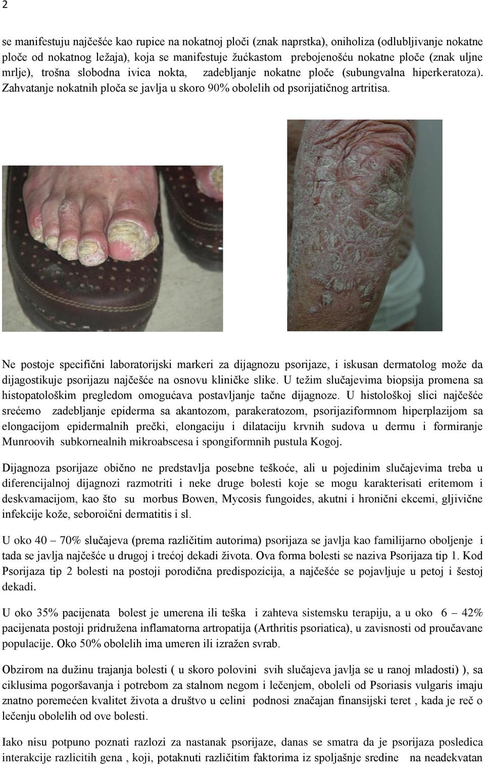 Ne postoje specifični laboratorijski markeri za dijagnozu psorijaze, i iskusan dermatolog može da dijagostikuje psorijazu najčešće na osnovu kliničke slike.