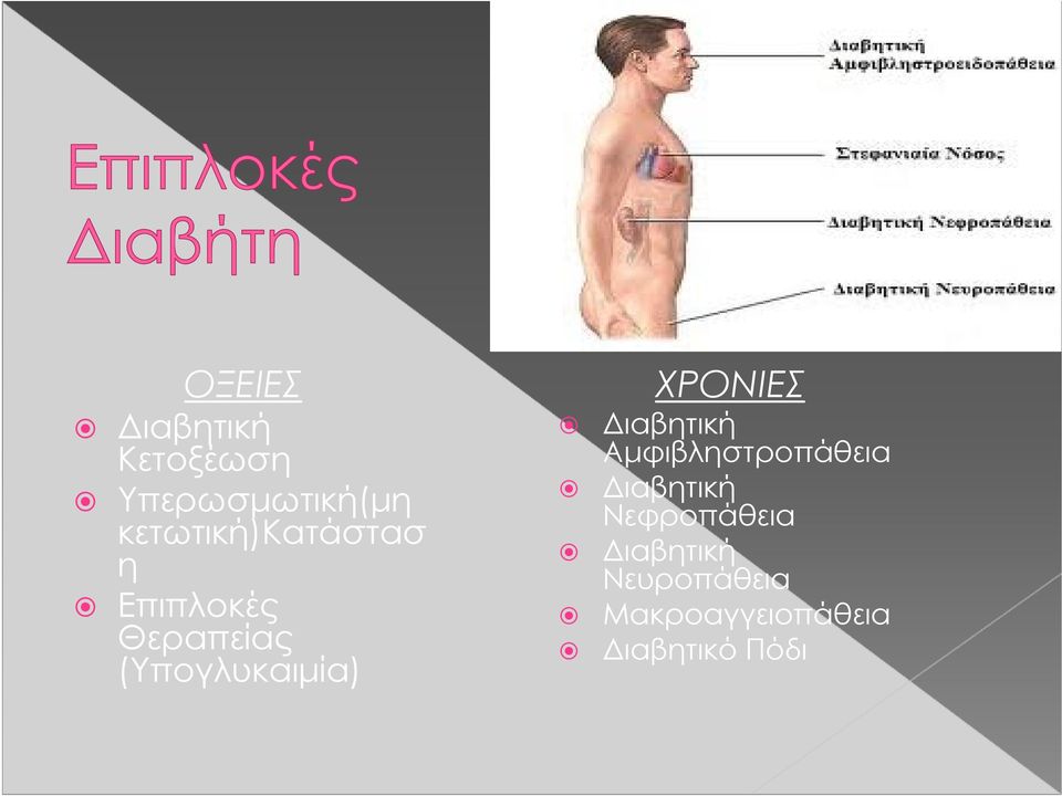 (Υπογλυκαιμία) ΧΡΟΝΙΕΣ Διαβητική Αμφιβληστροπάθεια