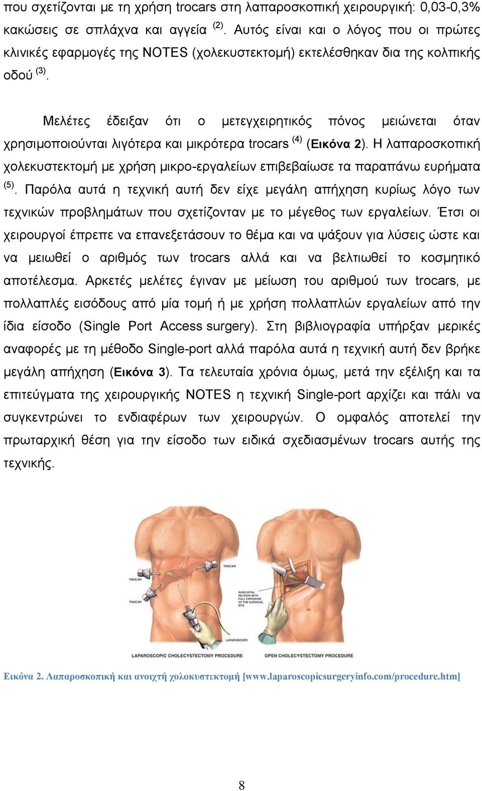 Μειέηεο έδεημαλ φηη ν κεηεγρεηξεηηθφο πφλνο κεηψλεηαη φηαλ ρξεζηκνπνηνχληαη ιηγφηεξα θαη κηθξφηεξα trocars (4) (Εικόνα 2).