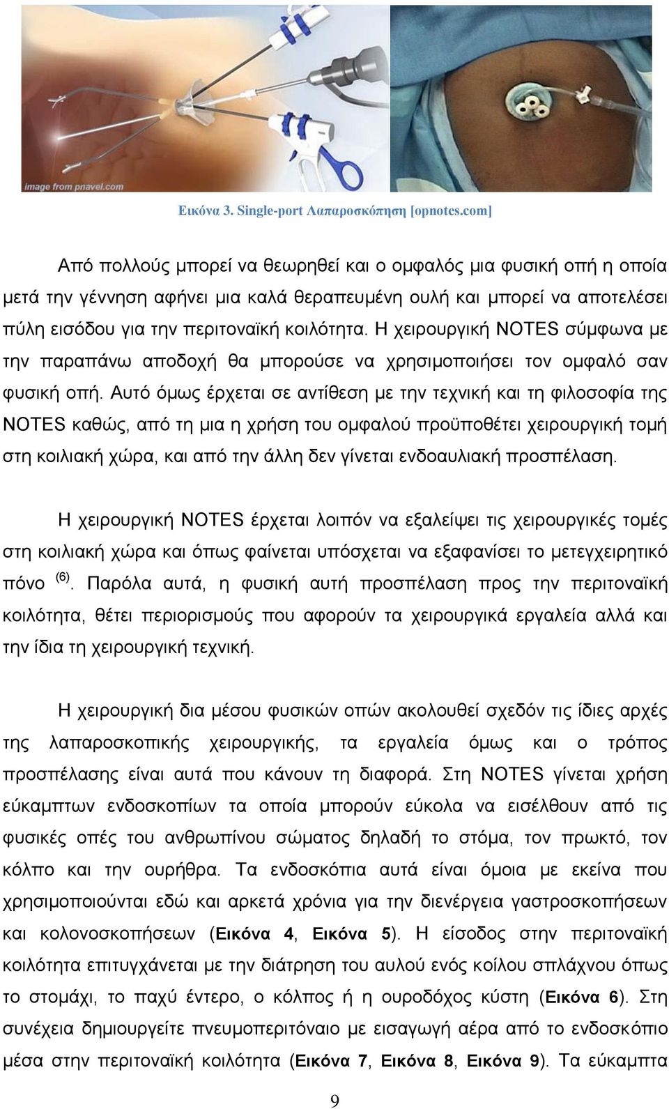 Ζ ρεηξνπξγηθή NOTES ζχκθσλα κε ηελ παξαπάλσ απνδνρή ζα κπνξνχζε λα ρξεζηκνπνηήζεη ηνλ νκθαιφ ζαλ θπζηθή νπή.