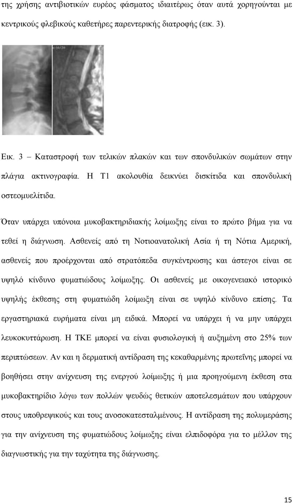 Όταν υπάρχει υπόνοια μυκοβακτηριδιακής λοίμωξης είναι το πρώτο βήμα για να τεθεί η διάγνωση.