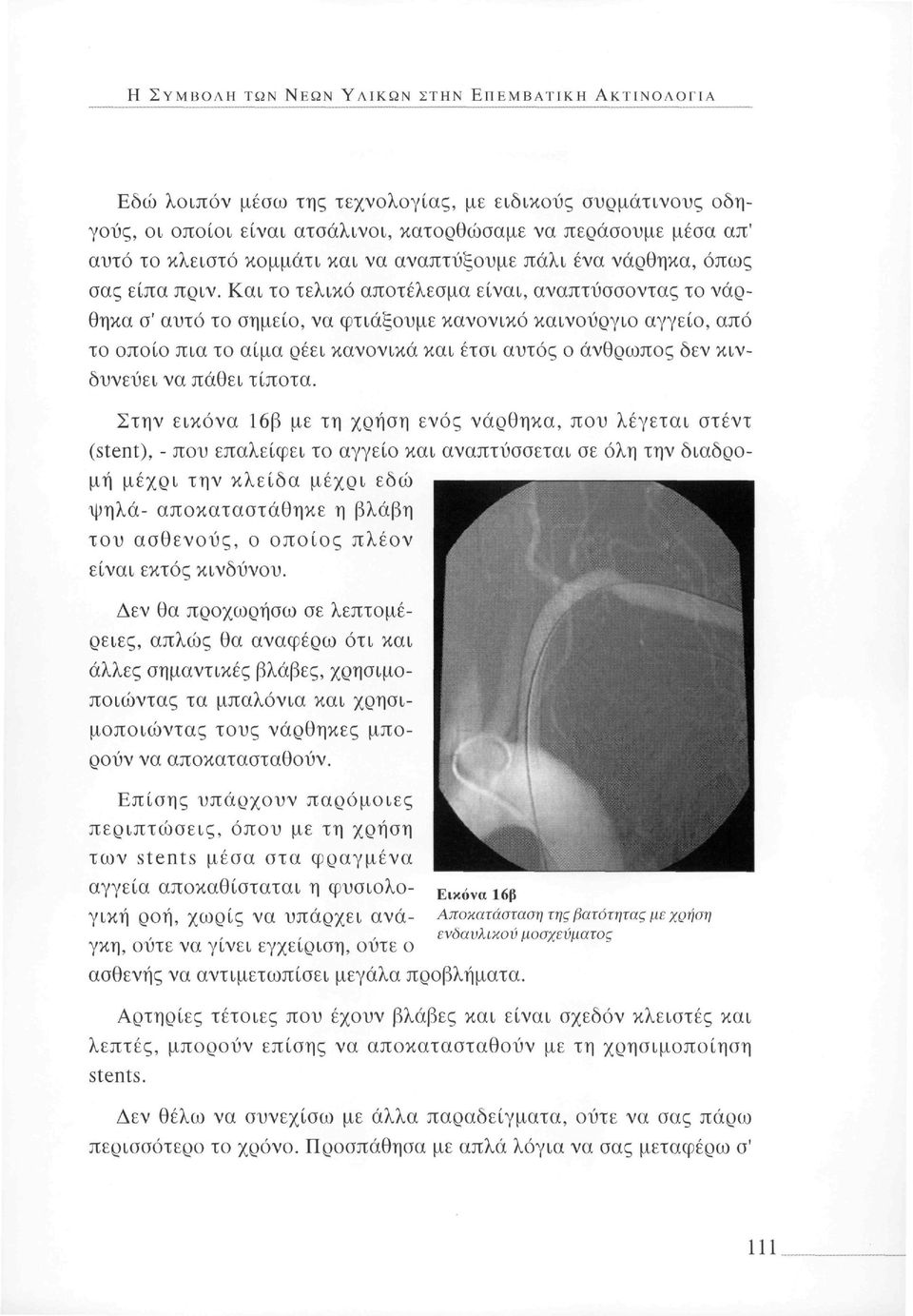 Και το τελικό αποτέλεσμα είναι, αναπτύσσοντας το νάρθηκα σ' αυτό το σημείο, να φτιάξουμε κανονικό καινούργιο αγγείο, από το οποίο πια το αίμα ρέει κανονικά και έτσι αυτός ο άνθρωπος δεν κινδυνεύει να