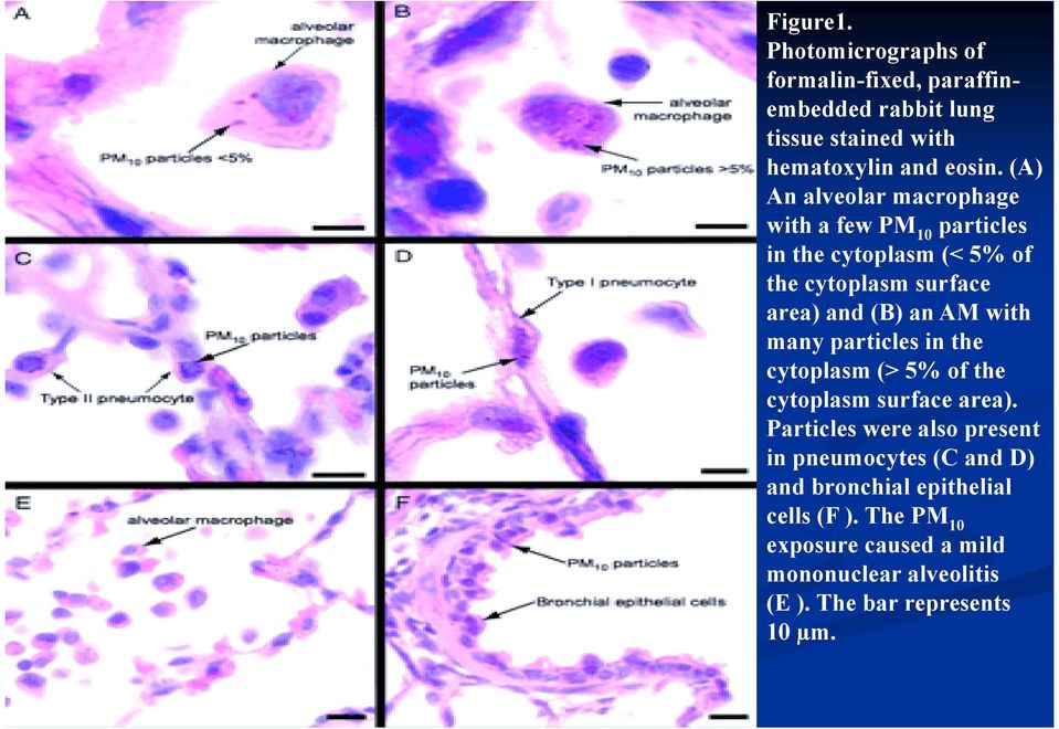 with many particles in the cytoplasm (> 5% of the cytoplasm surface area).