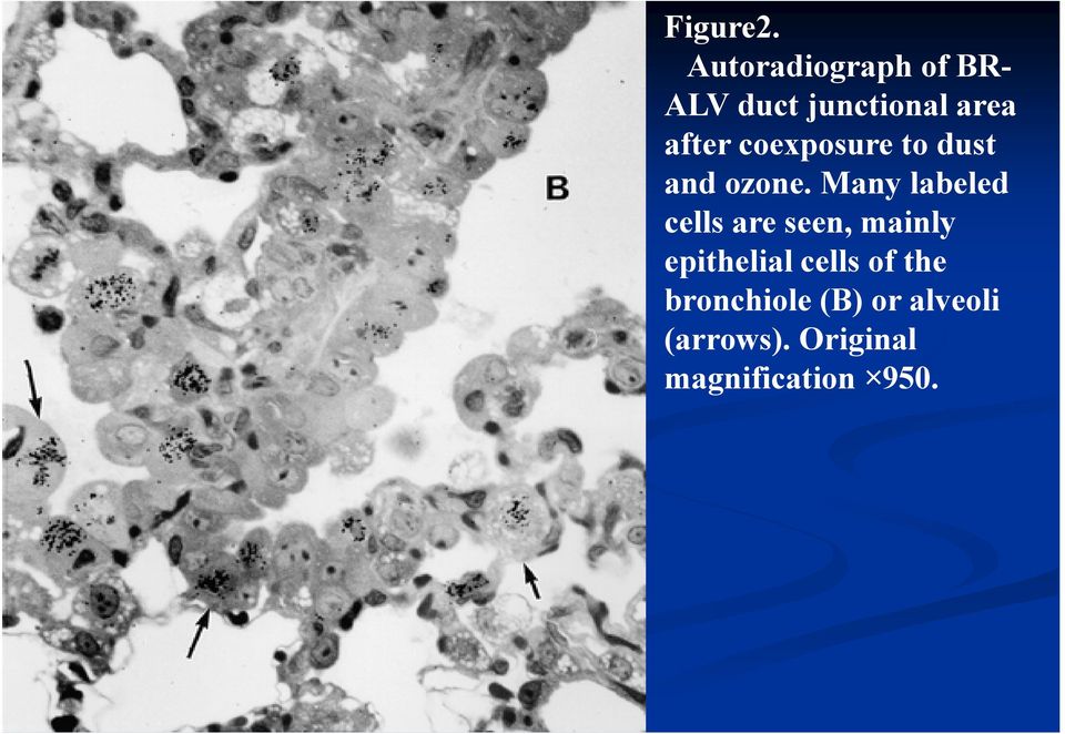 coexposure to dust and ozone.