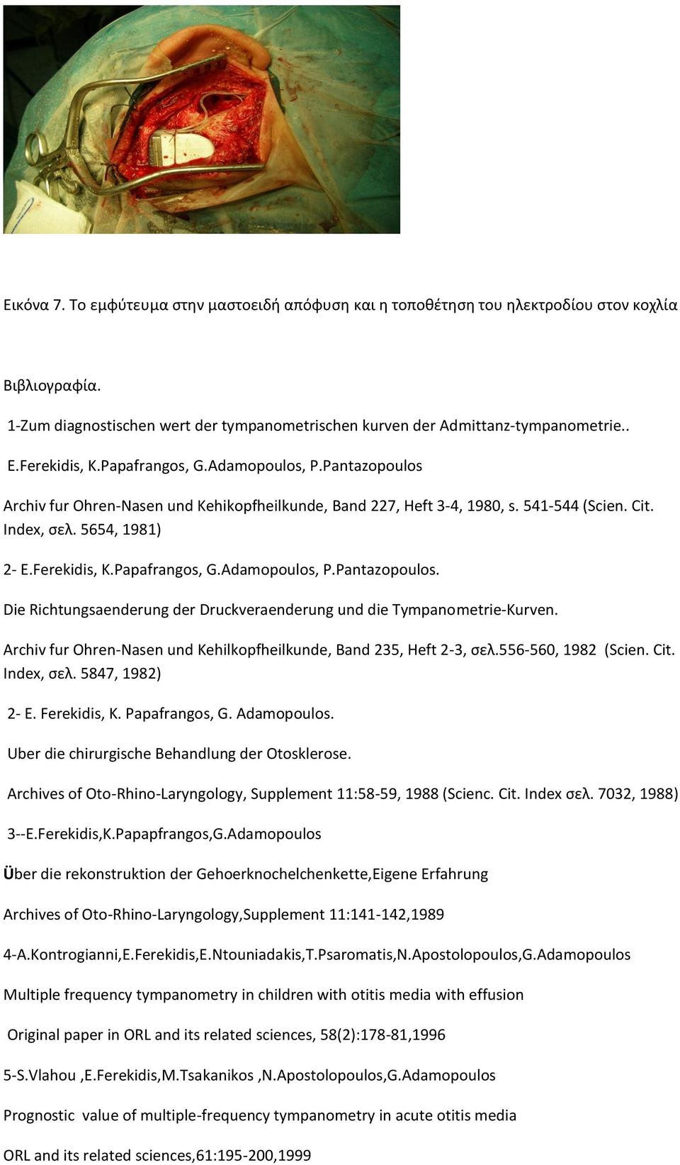 Αrchiv fur Ohren-Nasen und Kehilkopfheilkunde, Band 235, Heft 2-3, σελ.556-560, 1982 (Scien. Cit. Index, σελ. 5847, 1982) 2- E. Ferekidis, K. Papafrangos, G. Adamopoulos.