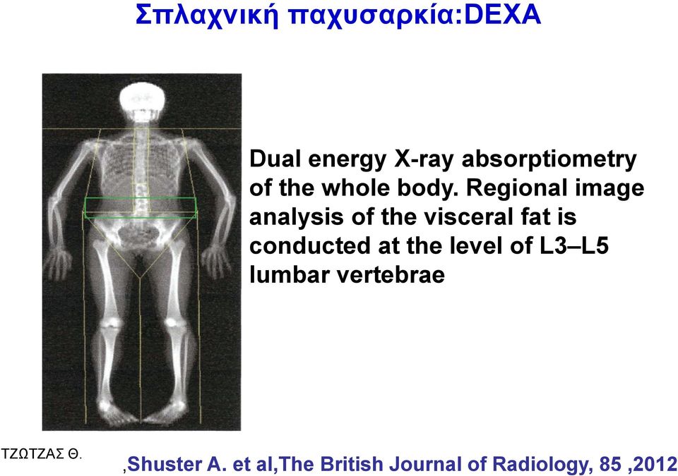 Regional image analysis of the visceral fat is conducted