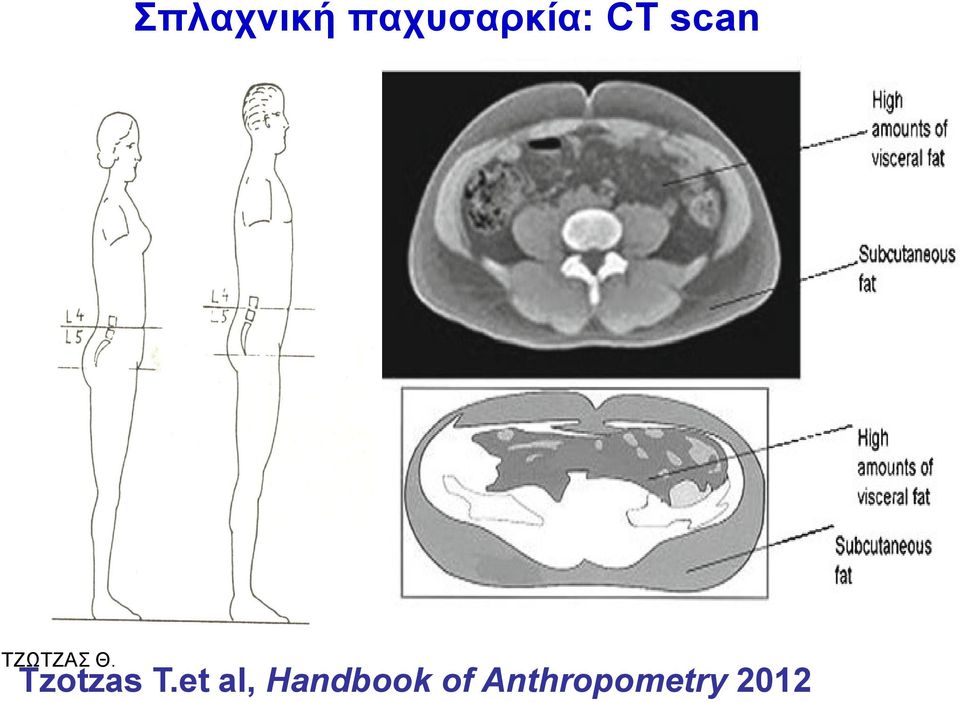 scan Tzotzas Σ.