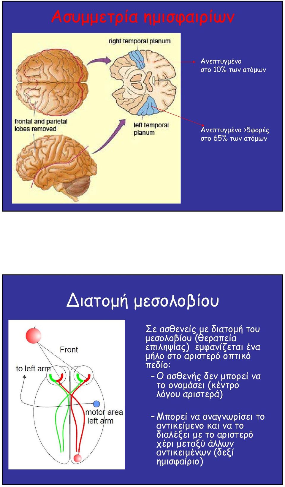 αριστερό οπτικό πεδίο: Ο ασθενής δεν µπορεί να το ονοµάσει (κέντρο λόγου αριστερά) Μπορεί να