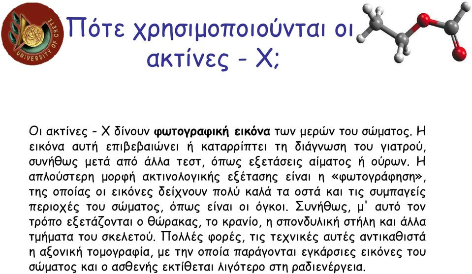 Η απλούστερη µορφή ακτινολογικής εξέτασης είναι η «φωτογράφηση», της οποίας οι εικόνες δείχνουν πολύ καλά τα οστά και τις συµπαγείς περιοχές του σώµατος, όπως είναι οι