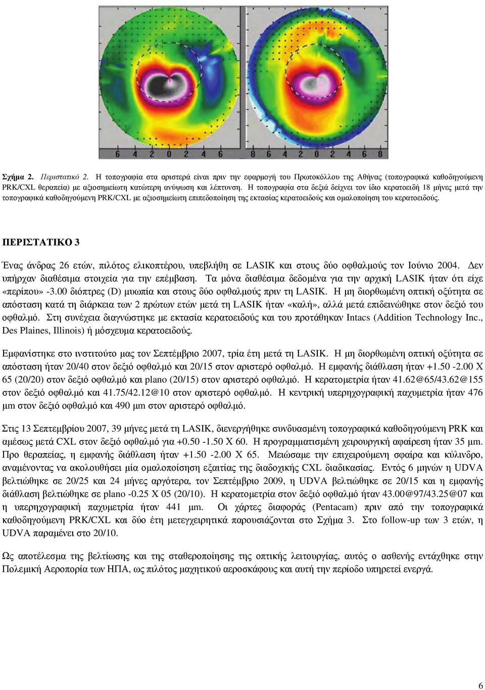 ΠΕΡΙΣΤΑΤΙΚΟ 3 Ένας άνδρας 26 ετών, πιλότος ελικοπτέρου, υπεβλήθη σε LASIK και στους δύο οφθαλμούς τον Ιούνιο 2004. Δεν υπήρχαν διαθέσιμα στοιχεία για την επέμβαση.