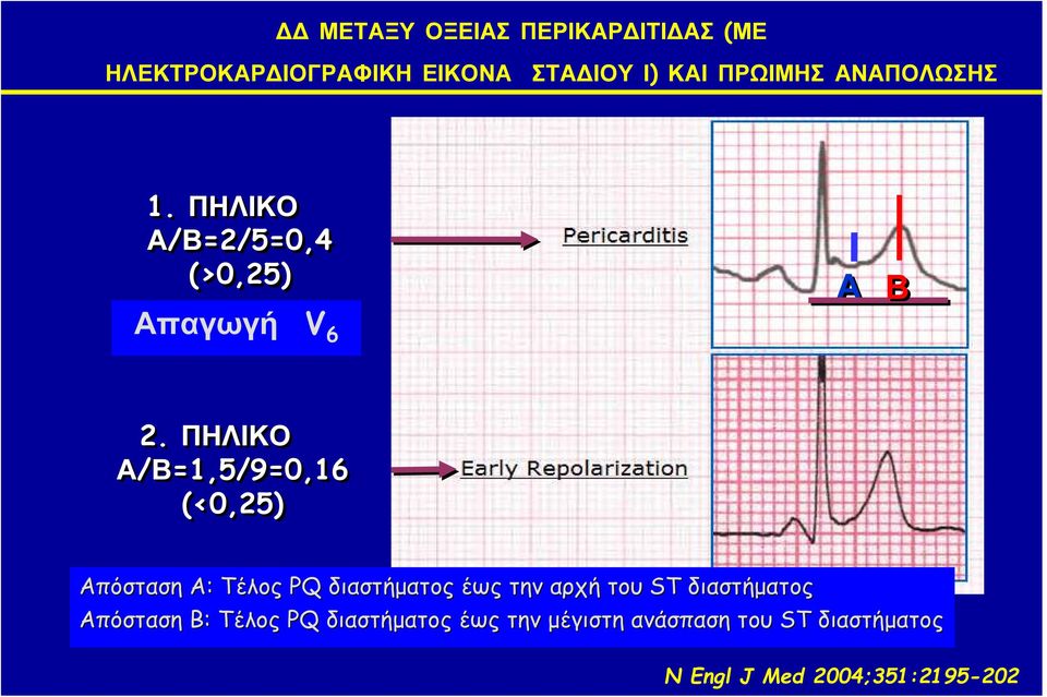 ΠΗΛΙΚΟ Α/Β=1,5/9=0,16 (<0,25) Απόσταση Α: Τέλος PQ διαστήματος έως την αρχή του ST